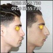 09385555730